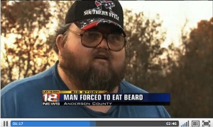 Man Forced To Eat Own Beard In Botched Lawnmower
Sale