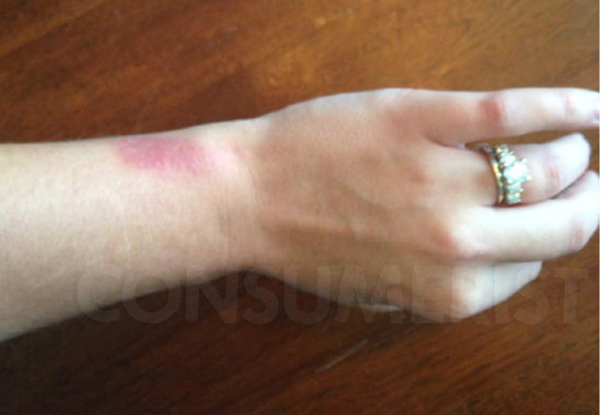 Fitbit Apologizes To “Very Limited Number Of” Force Owners With Skin Irritation