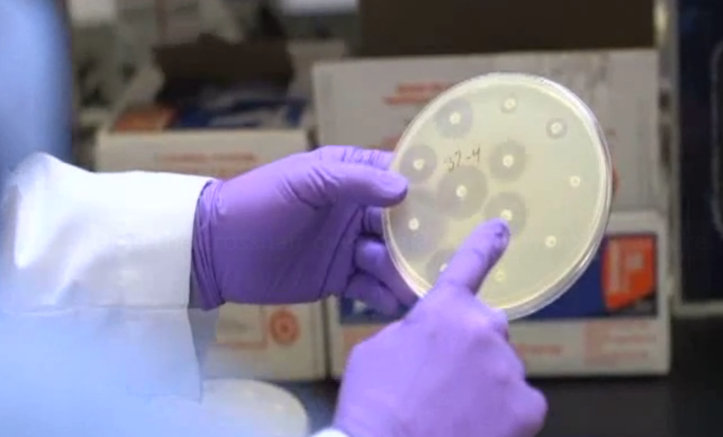 You can see by the small or nonexistent reactions around the dots on the right that the e. coli in this petri dish is resistant to those  particular antibiotics.