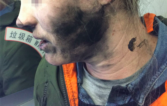 Passenger’s Headphones Explode During Flight