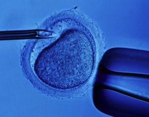 Want To Save Money On Fertility Treatments? Go Straight To In Vitro