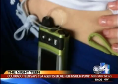 Teenager Says TSA Screeners Are Responsible For Breaking $10K Insulin Pump