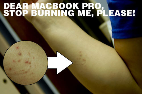 Macbook Pro Shocks Owner, Leaves Marks