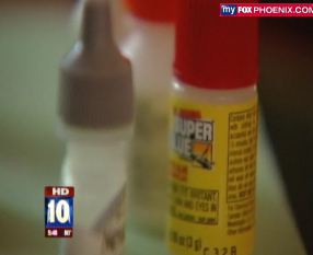 Woman Mistakes Superglue For Eyedrops; Not As Funny As It Sounds