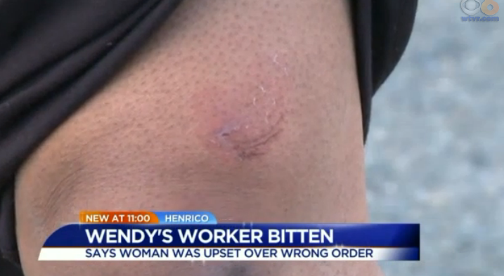 A Wendy's manager says she was bitten by an angry customer.