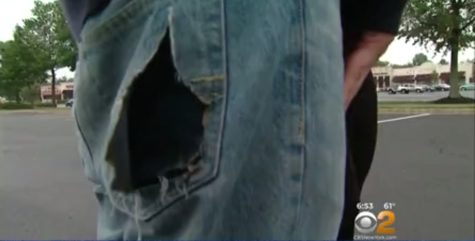College Student Claims iPhone Caught Fire In Pocket During Class